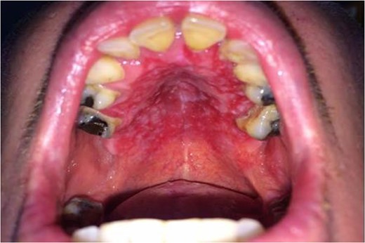 Clinical appearance at initial presentation.