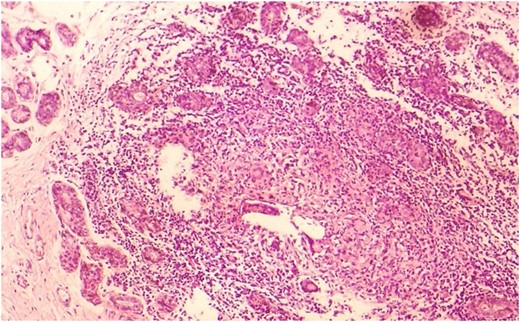 IGM histopathological image (HE X10).