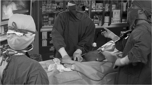 Snapshot of the TAPP repair, with external compression being applied to the
                        groin from outside of the body.