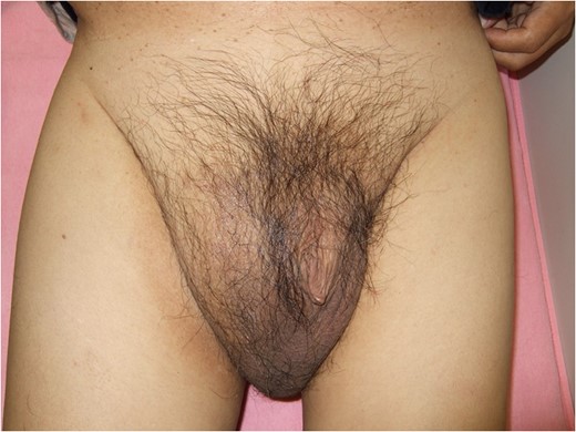 Photo of the patient approximately 1 year after the surgery.