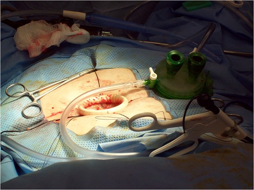 Commercially available SPA.