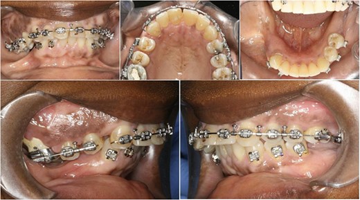 Pre-surgical photographs.