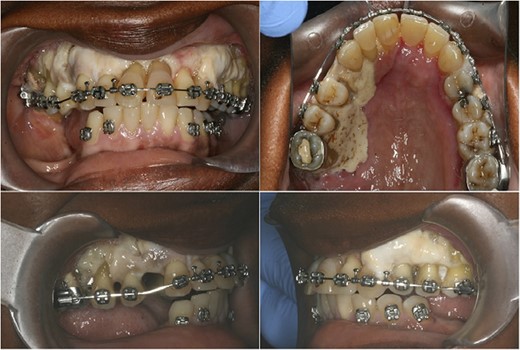 Photographs at 26 days post surgery.