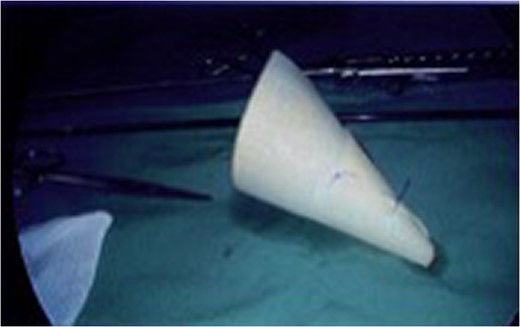 Photograph of the Gore BioA tissue reinforcement mesh.