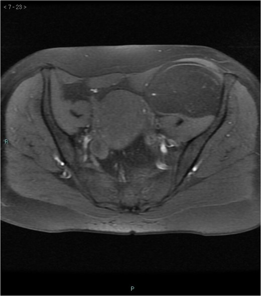 MRI axial-T1w fat-sat.