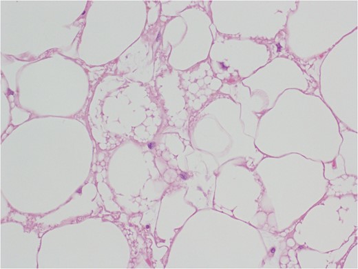 Morphologic evaluation H & E stain.