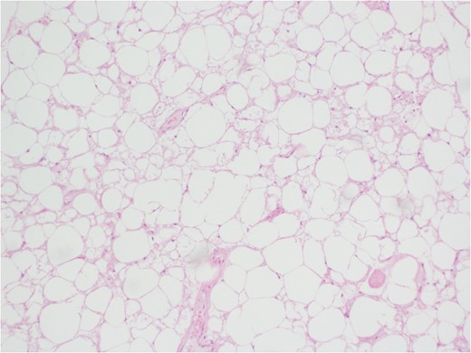 Morphologic evaluation H & E stain.