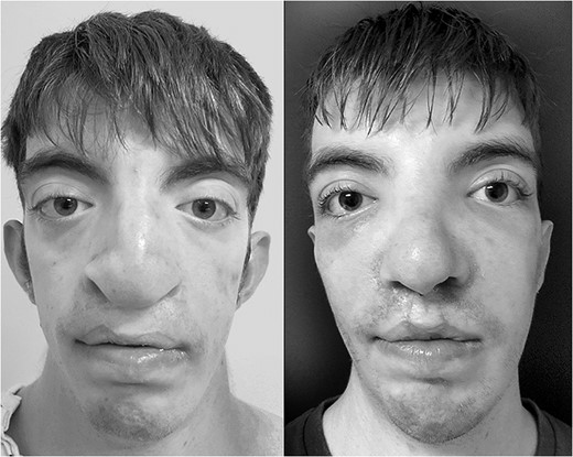 Side by side comparison of preoperative findings and postoperative results.