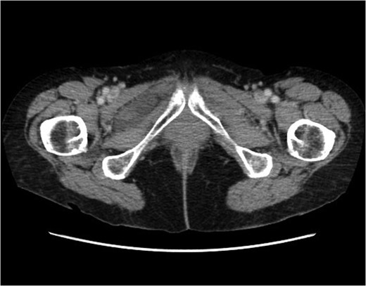 Transverse plane. As above.
