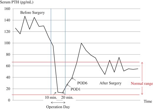 Serum PTH concentrations before and after surgery. After the immediate reduction during surgery, serum PTH level returned to normal range.