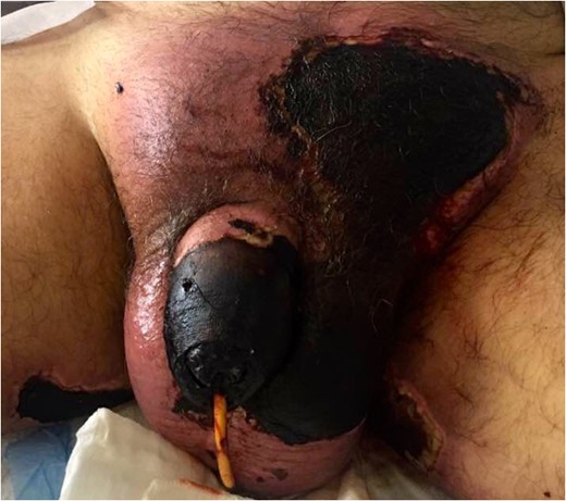 Prior to surgical debridement.