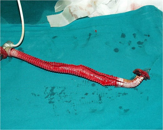 There are no thrombus inside the device.