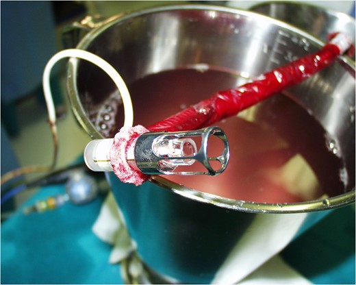 The inflow tip of the device.