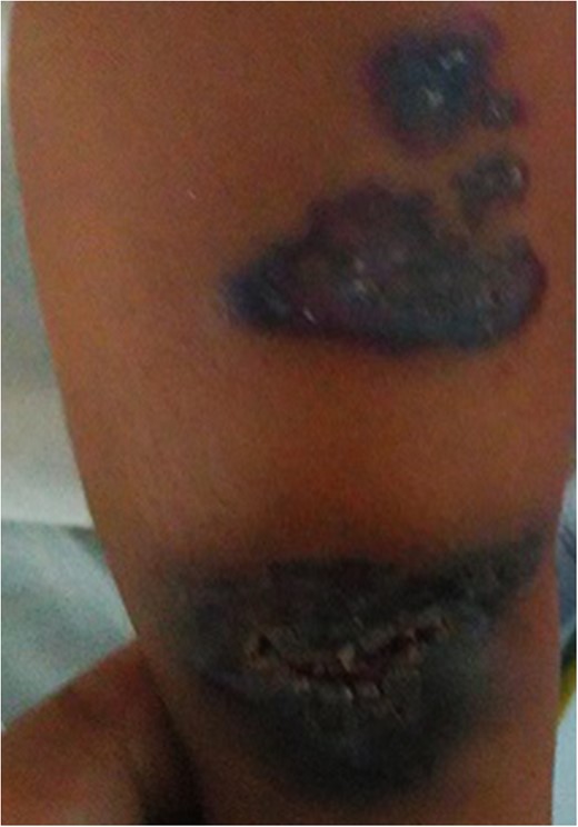 Gross examination of the lesion.