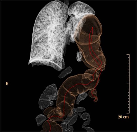 3D CT reconstruction.
