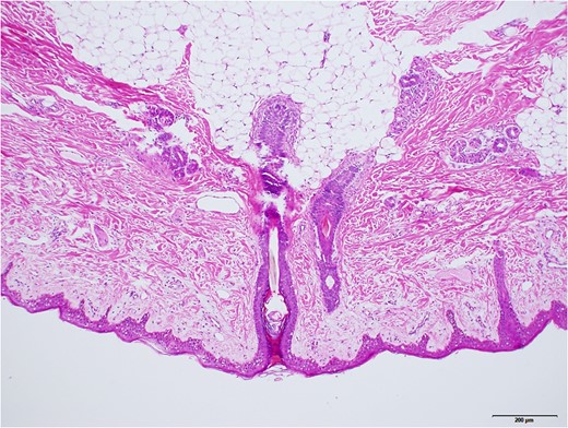 Higher magnified surface area, taken with ×10 objective lens. Black bar represents 200 μm. Mature hair follicles, sebaceous glands, and sweat glands were observed.