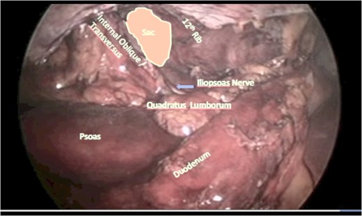 The wide mobilization completed.