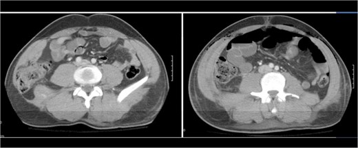 A comparison of pre-operative and post-operative imaging.