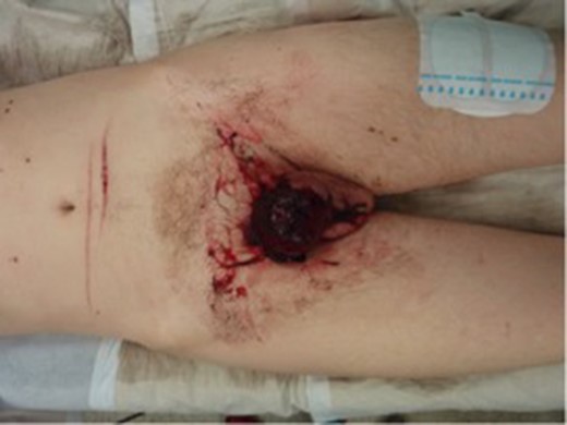 Image showing patient’s injuries at time of presentation.