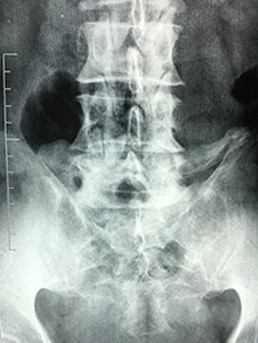 graphic