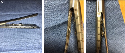 (A–C) Powered Endo-GIA stapler after intraoperative mechanical damage.