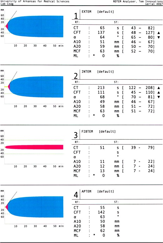 Preoperative ROTEM.