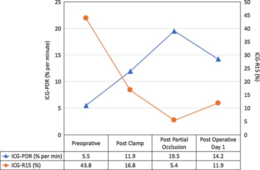 Perioperative measurements of indocyanine green (ICG) clearance is effective for the intra-operative evaluation of hepatic function. ICG-PDR, indocyanine green plasma disappearance rate; ICG-R15, indocyanine green retention ratio after 15 min.