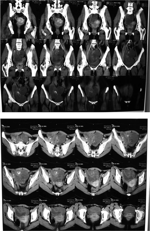 CT scan.