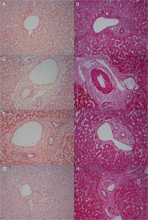 Representative histological samples to assess architectural integrity and necrosis by H&E staining (A, C, E, G) as well as glycogen content using Periodic acid-Schiff staining (B, D, F, H). Samples taken prior to commencement of NMP-L (A, B), after 3 h of NMP-L (C, D), after 6 h of NMP-L (E, F) and after parenchymal splitting with concurrent NMP-L (G, H).