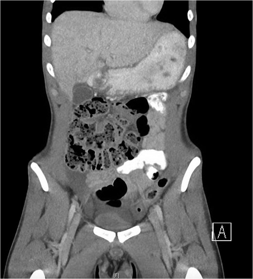 Computed tomography imaging of patient.