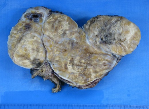Histopathology.