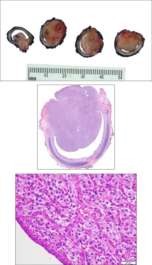 Pathologic imaging.