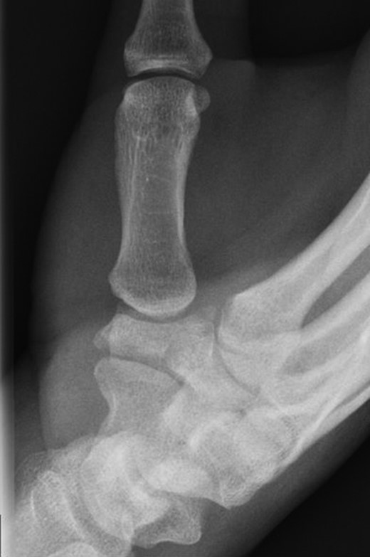 Pre-operative plain radiograph.