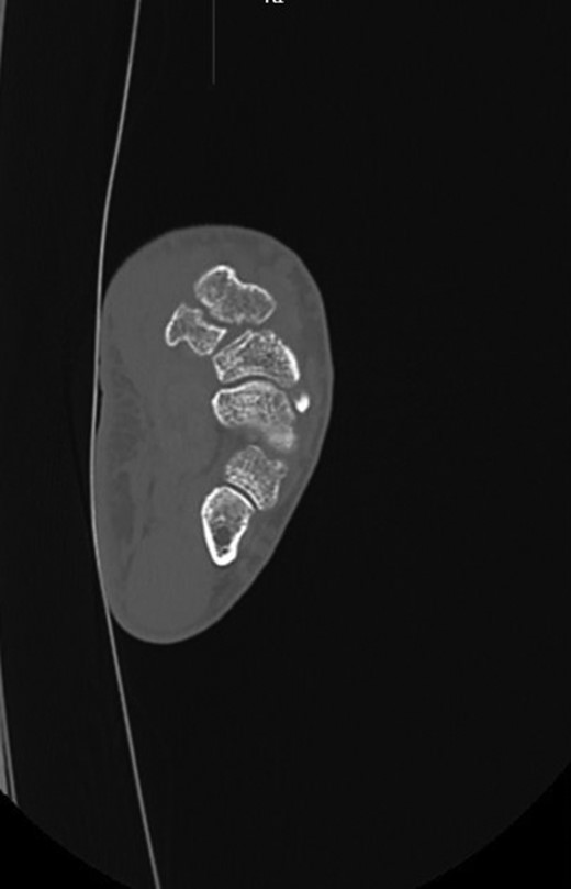 Pre-operative CT image.