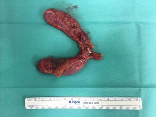 Gross specimen examination.
