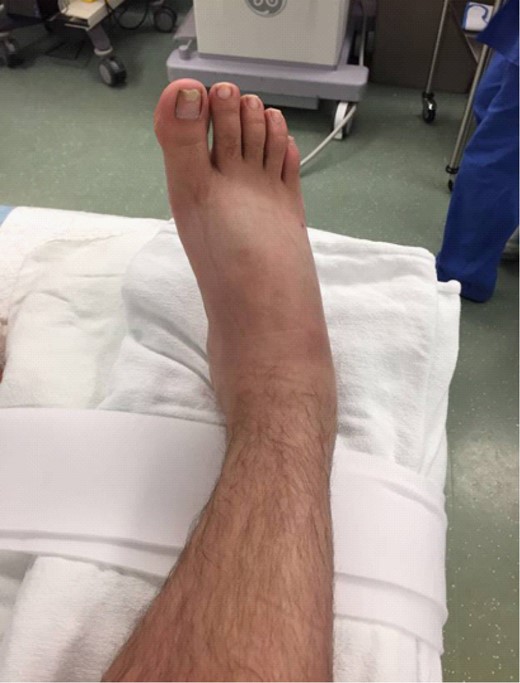 Patient’s right ankle.