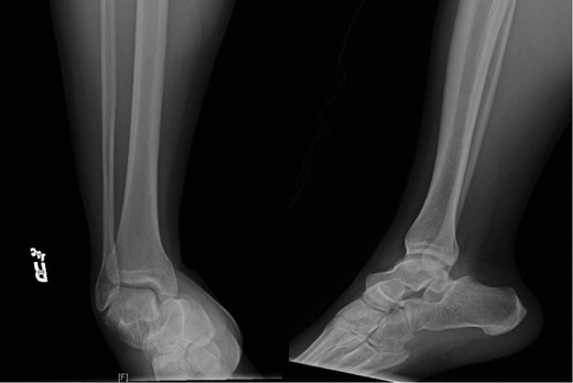 Presenting X-rays of the right ankle.