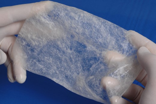 ACell® decellularized porcine urinary bladder matrix over the defect to aid in granulation formation and to facilitate healing.