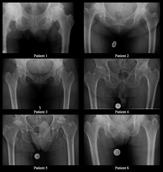 Preoperative radiographs.