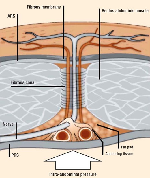 The nerves of the anterior abdominal wall and their double right-angle course at the lateral edge of rectus abdominis muscle.