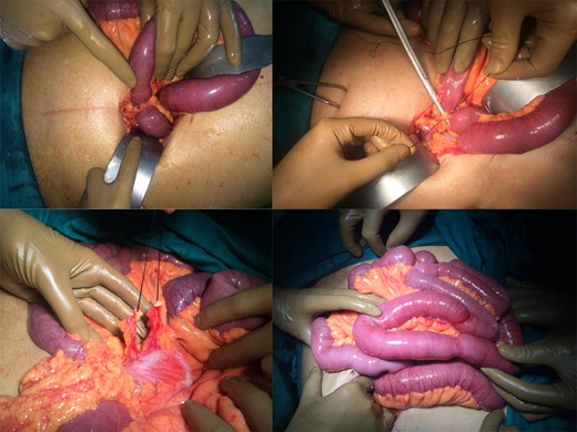 Operative pictures.