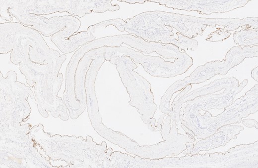Desmin immunohistochemical staining.