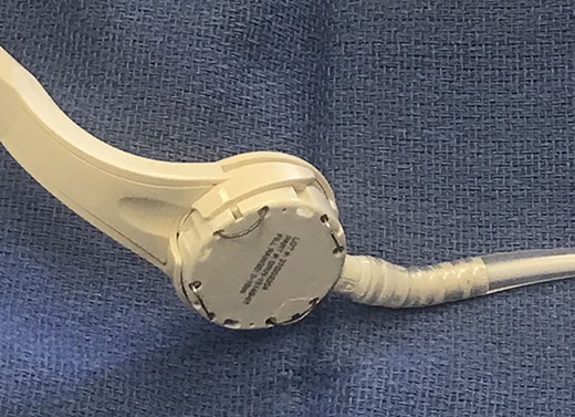 RapidPort with expandable prongs.