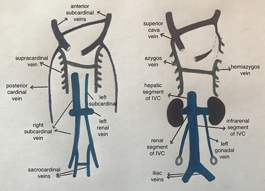 Development of IVC.