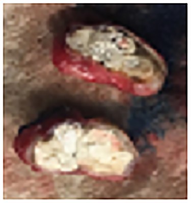 Cut section of left lower lobe nodule.