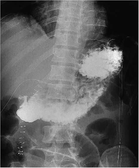 Contrast follow-through study.