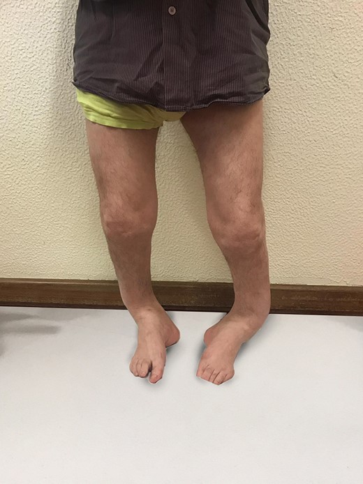 Lower limbs of his father.