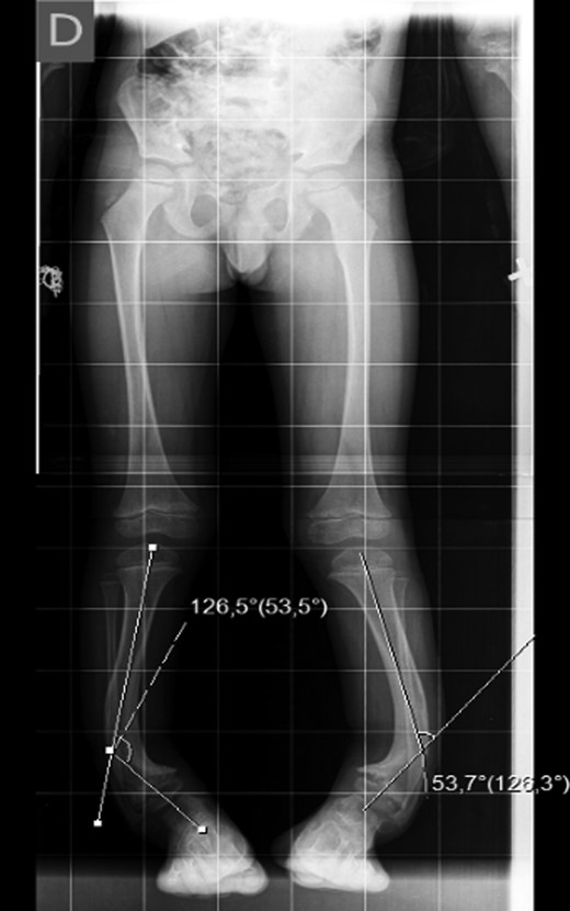 Preoperative Rx.