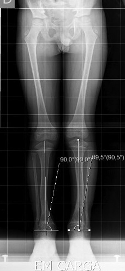 The Rx 1 year after the surgery.