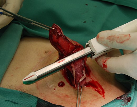 The isolated intestinal tract was separated using the same device as the direction of the minor axis.